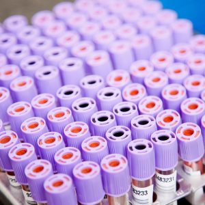 ANTICUERPOS ANTI DENGUE IgG IgM / ANTIGENO NS1