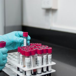 QUÍMICA SANGUÍNEA QS 6