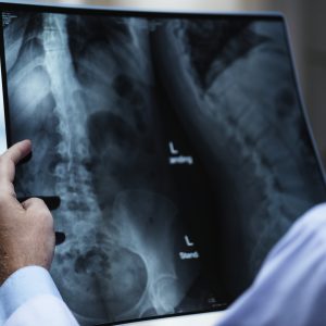 RESONANCIA LUMBAR